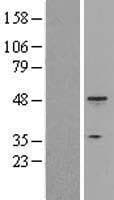 KRT18 / CK18 / Cytokeratin 18 Protein (Over-Expression Lysate Myc-DDK (Flag))