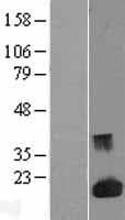 LGALS1 / Galectin 1 Protein (Over-Expression Lysate Myc-DDK (Flag))