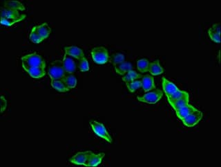 CPLX1 / Complexin 1 Antibody