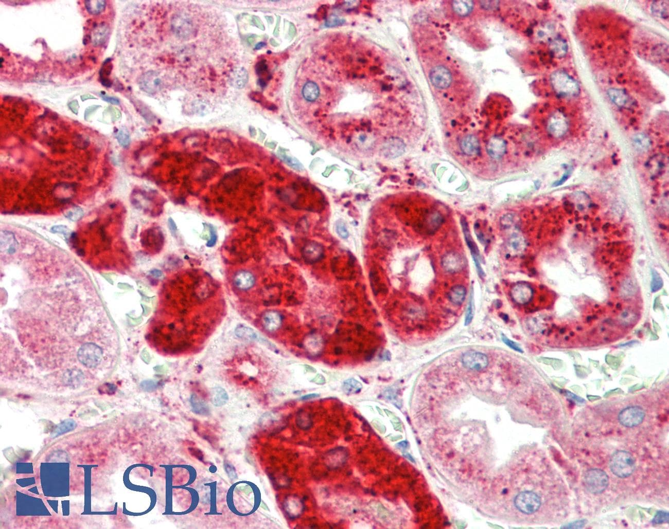 IHC-plus™ CTSC / Cathepsin C / JP Antibody (aa238-252)