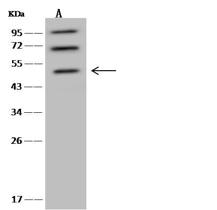 Polyclonal Rabbit anti-Human NLE1 Antibody (IHC, WB)