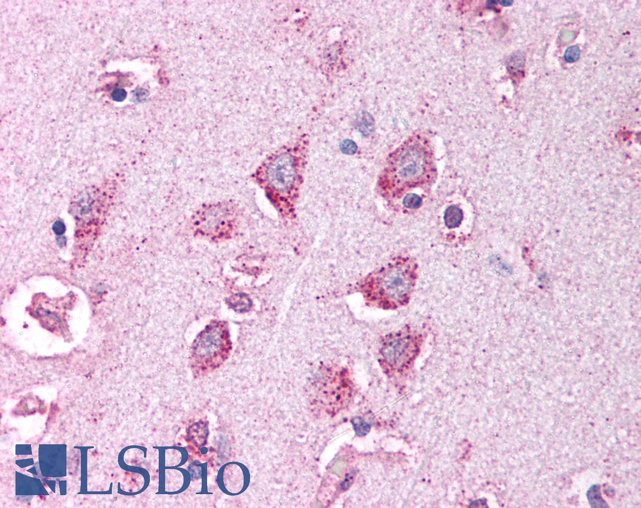 PathPlus™ Polyclonal Rabbit anti-Human HTRA2 / OMI Antibody (IHC, IF, WB)