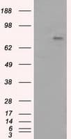 BTK Antibody (clone OTI3A2)