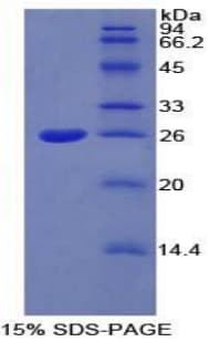 Rat CP / Ceruloplasmin Protein (Recombinant His-T7)