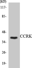 Polyclonal Rabbit anti-Human CDK20 / CCRK Antibody (aa33-82, WB)