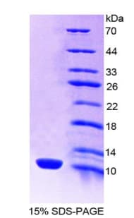 Rat SLC6A3 / Dopamine Transporter Protein (Recombinant His-T7)