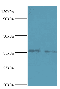 Polyclonal Rabbit anti-Human BRCC3 / BRCC36 Antibody (aa1-316, IHC, WB)
