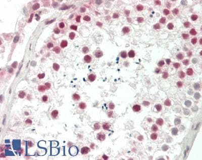 IHC-plus™ Polyclonal Rabbit anti-Human PDS5A Antibody (aa1250-C-term, IHC, WB)