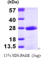Human PMVK Protein (Recombinant His)
