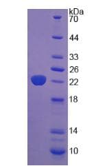 Human PTHR / PTHR1 Protein (Recombinant His)