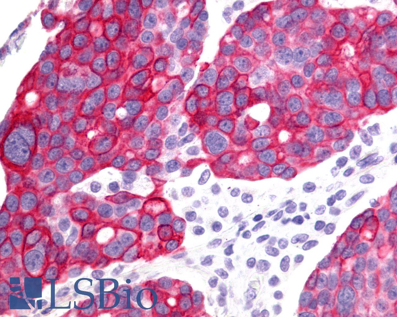 IHC-plus™ GHRHR Antibody (N-Terminus)