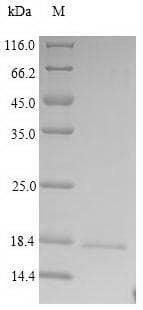 Human CRBN / Cereblon Protein (Recombinant 6His, C-terminus)
