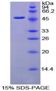 Chicken FGG / Fibrinogen Gamma Protein (Recombinant His)