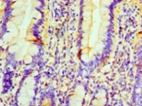 Polyclonal Rabbit anti-Human PRUNE Antibody (IHC)