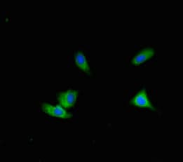ALG12 Antibody