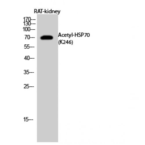 HSPA1A Antibody (Internal)