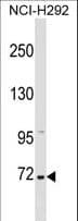 ZNF571 Antibody (aa38-64)