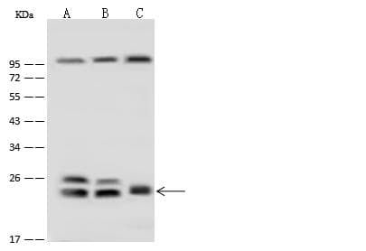 RAB5B Antibody