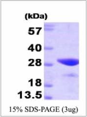 Human GSR / Glutathione Reductase Protein (Recombinant His)