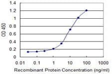 SLC20A2 / PIT2 Antibody (clone 4B1)