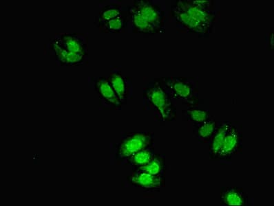 Polyclonal Rabbit anti-Human CYGB / Cytoglobin Antibody (aa1-190)