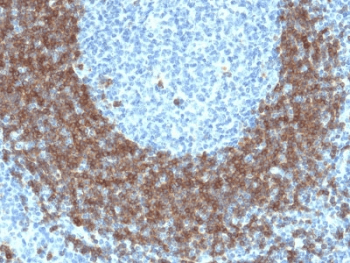 Monoclonal Mouse anti-Human CD79B / CD79 Beta Antibody (clone IGB/1842, IHC)