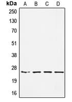 SSX Pan Antibody (C-Terminus)