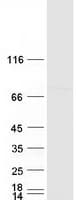 Human WDR46 Protein (Recombinant Myc-DDK (Flag))