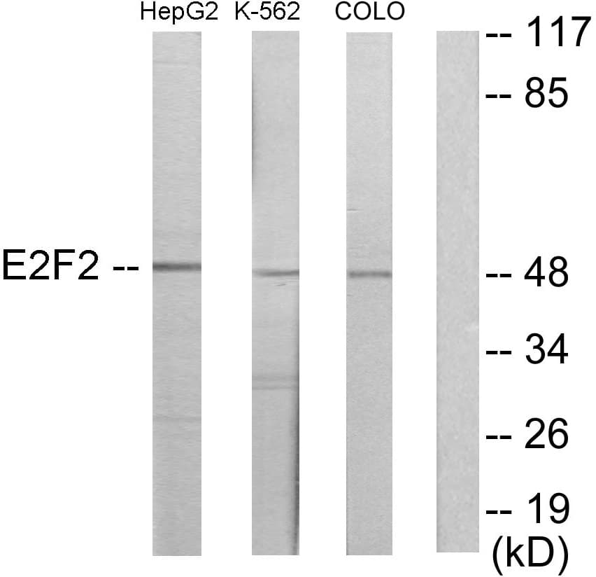 Polyclonal Rabbit anti-Human E2F2 Antibody (aa221-270, WB)