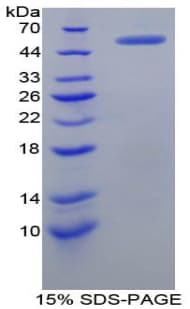 Human CR2 / CD21 Protein (Recombinant His-GST)