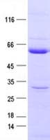 Human PTP1B Protein (Recombinant DDK,C-terminus)