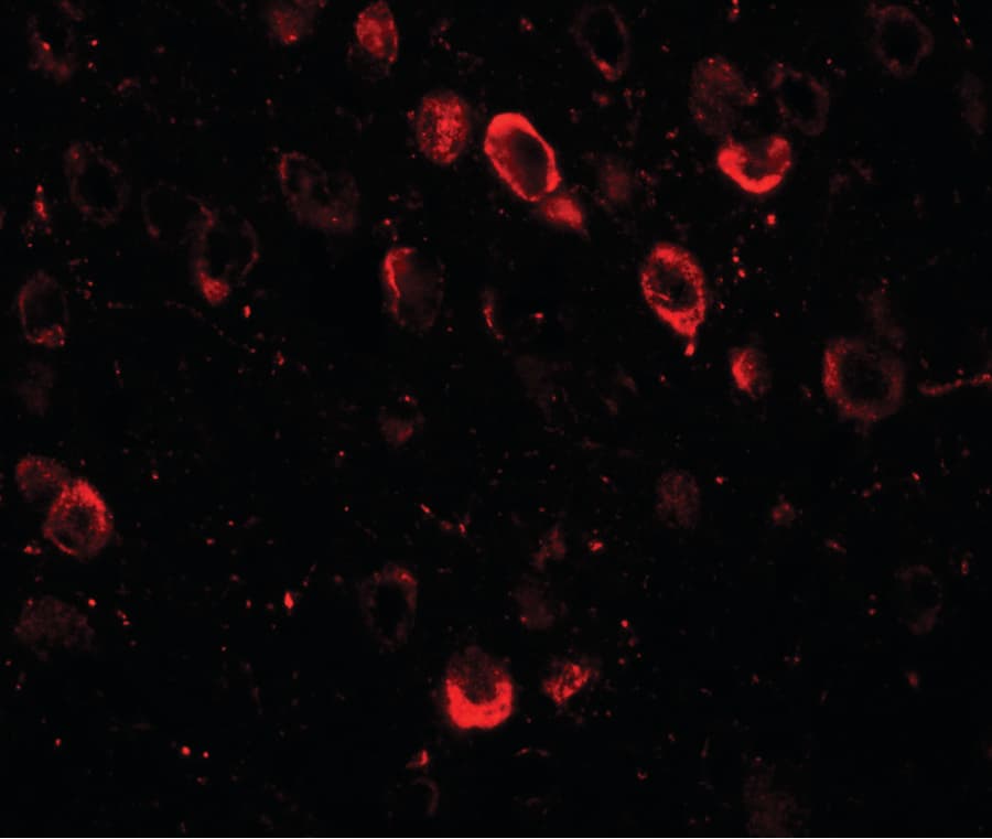 CMYA5 Antibody
