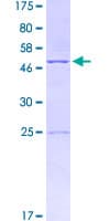 Human IL18 Protein (Recombinant GST)
