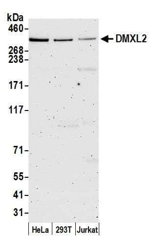 DMXL2 Antibody (aa1450-1500)
