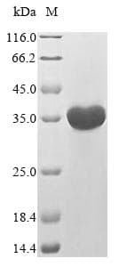 Mouse FPR1 / FPR Protein (Recombinant 10His-GST, N-terminus + Myc, C-terminus)