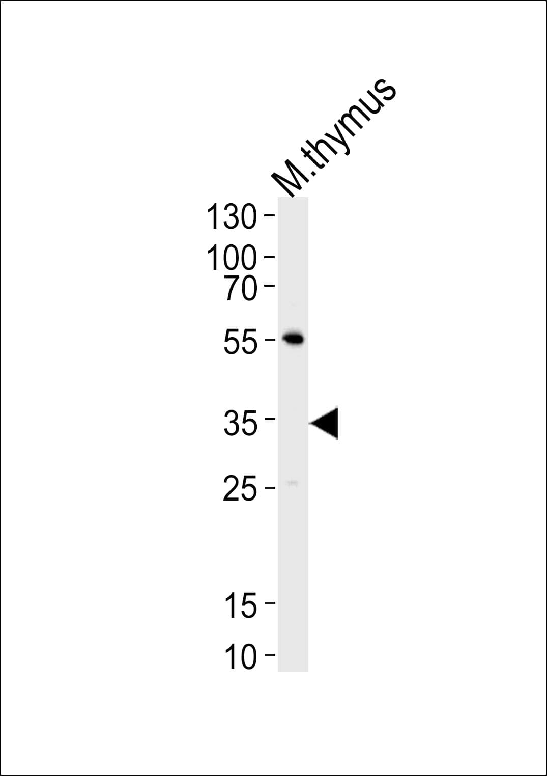 p56lck / LCK Antibody (aa20-47)