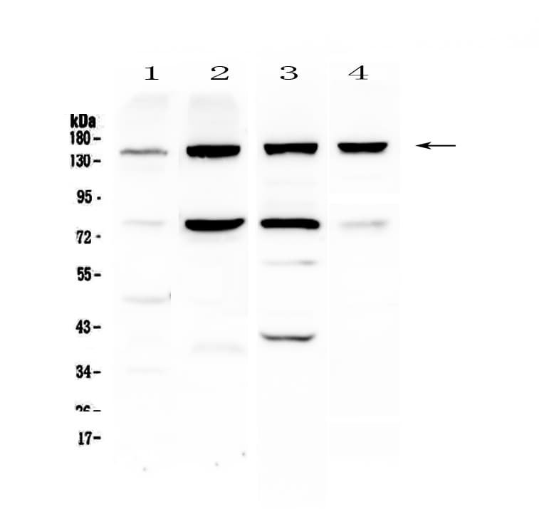 Polyclonal Rabbit anti-Human ITGA5/Integrin Alpha 5/CD49e Antibody (IHC, WB)