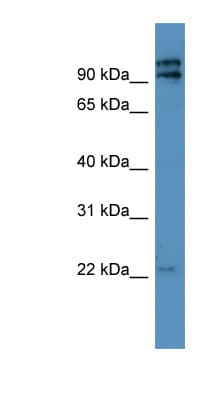 Polyclonal Rabbit anti-Human MRPL49 Antibody (aa40-89, WB)