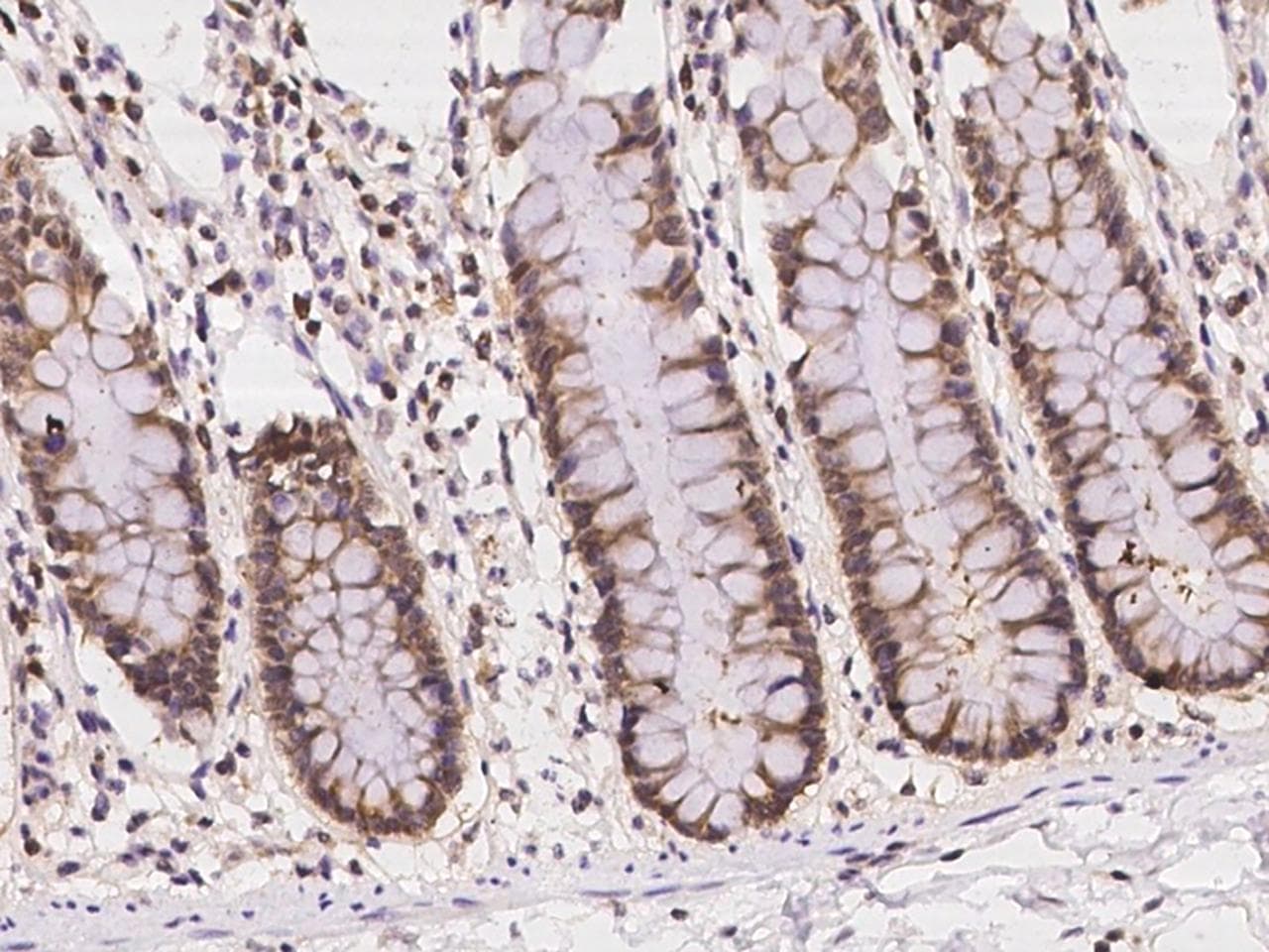 EIF1AY Antibody