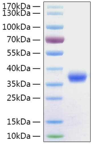 Coronavirus SARS-CoV-2 Spike Glycoprotein (Recombinant 6His, C-terminus)