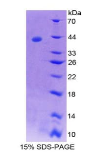Rat Neurokinin B Protein (Recombinant His-GST)