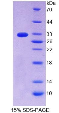 Human ERBB4 / HER4 Protein (Recombinant His-T7)