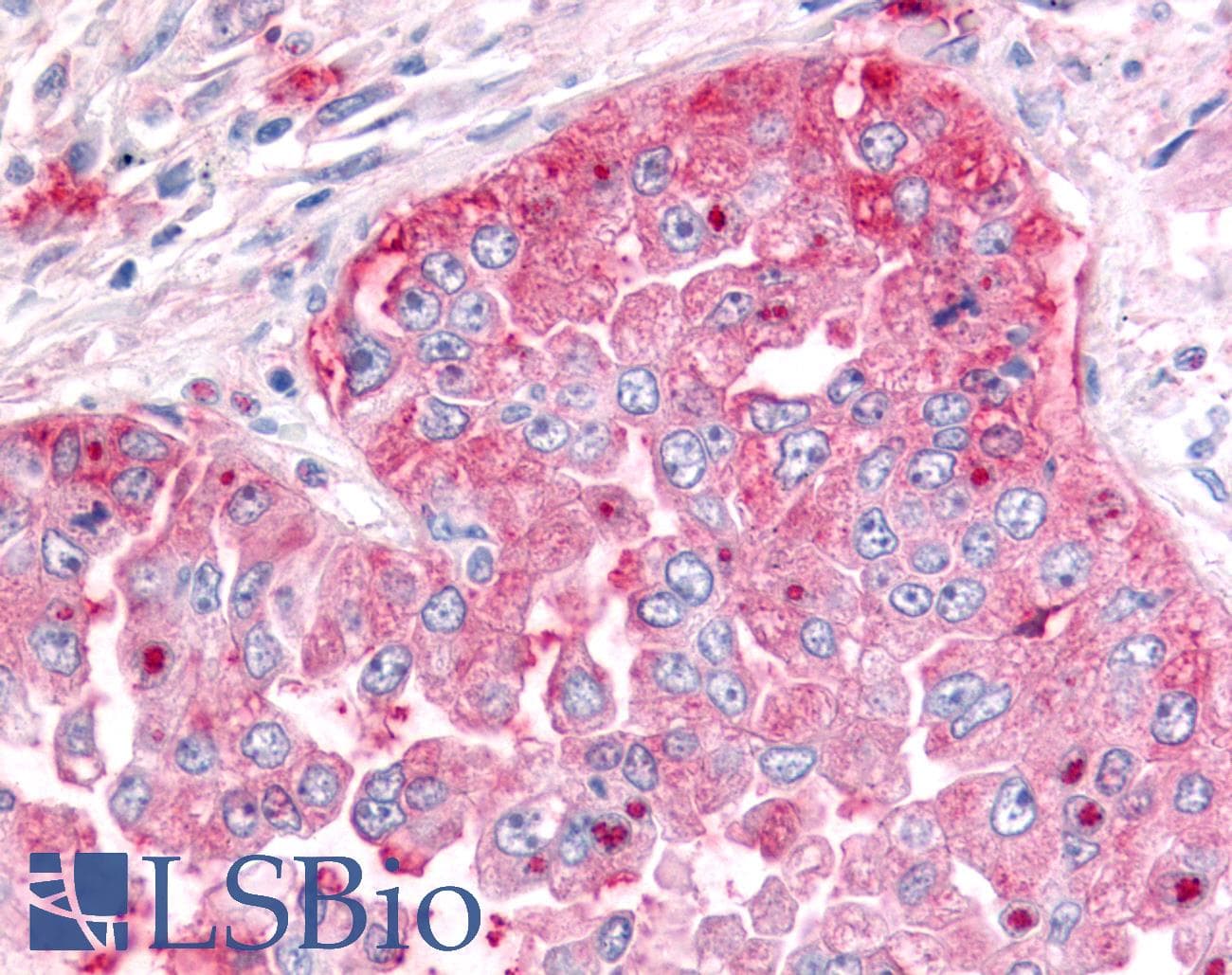PathPlus™ Polyclonal Rabbit anti-Human ADAMTS5 Antibody (C-Terminus, IHC)