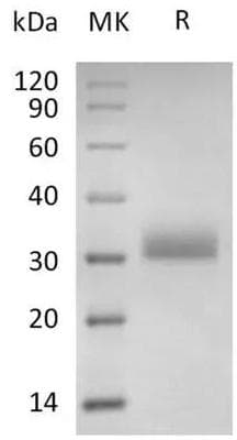 Coronavirus SARS-CoV-2 Spike Glycoprotein (Recombinant 6His, C-terminus)