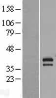 AEN Protein (Over-Expression Lysate Myc-DDK (Flag))