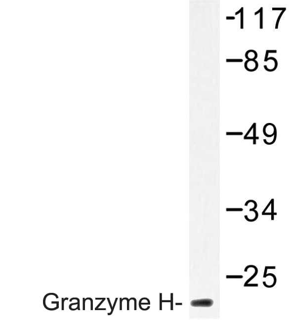 Polyclonal Rabbit anti-Human GZMH / Granzyme H Antibody (Gly75, IHC, IF, WB)