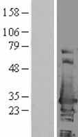 HSD17B10 / HADH2 Protein (Over-Expression Lysate Myc-DDK (Flag))