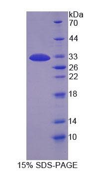 Mouse MAP1B Protein (Recombinant His-T7, N-terminus)