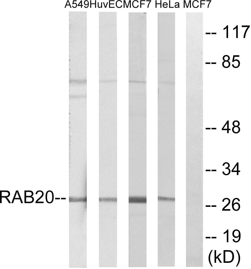RAB20 Antibody (aa115-164)