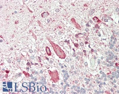 IHC-plus™ Polyclonal Rabbit anti-Human OR2T1 Antibody (200-280 aa, C-terminal, IHC, IF, WB)